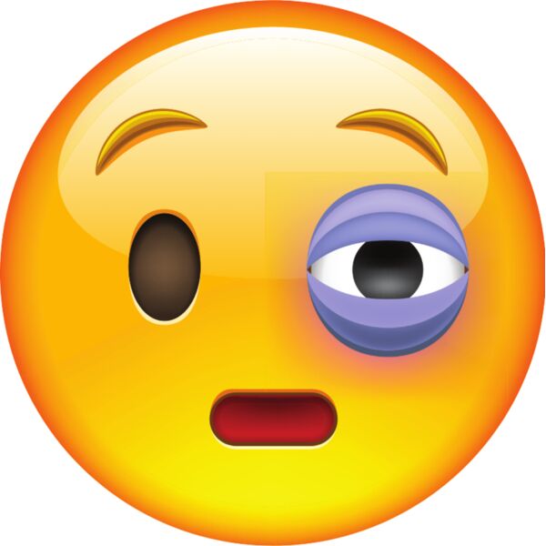 Bruised eye Thumbnail